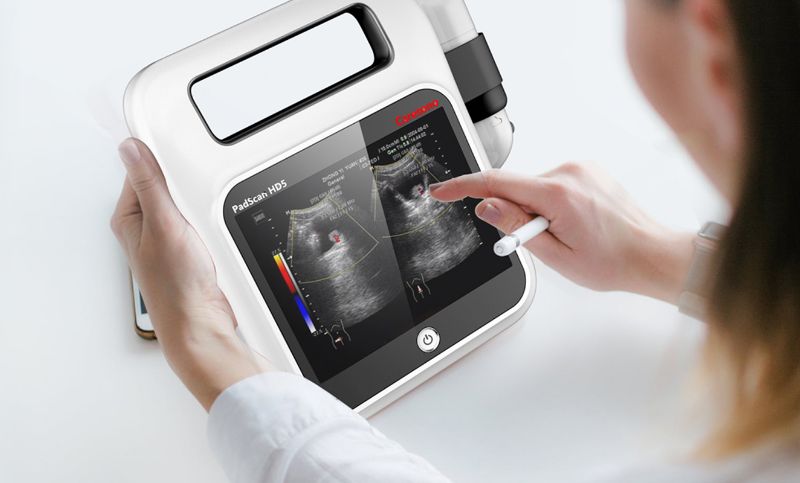 便携式膀胱检测仪扫描仪容量测量仪工业外观结构设计